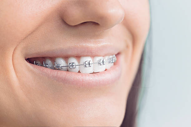 Laser Dentistry in Colonia, NJ